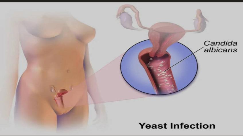 &lrm;DALILAI 5 DA KE HAIFAR DA CIWON MARA A MATA