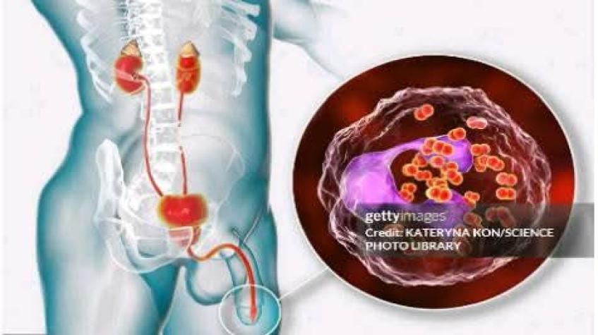 Kalolin abincin da ke ƙara lafiyar mazaƙuta (sperm) ga maza 