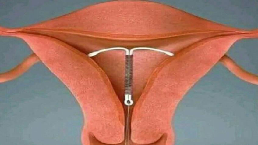 Kalolin abincin da yake karfafa lafiyar farji, mahaifa, da gabobin haihuwa gaba daya.